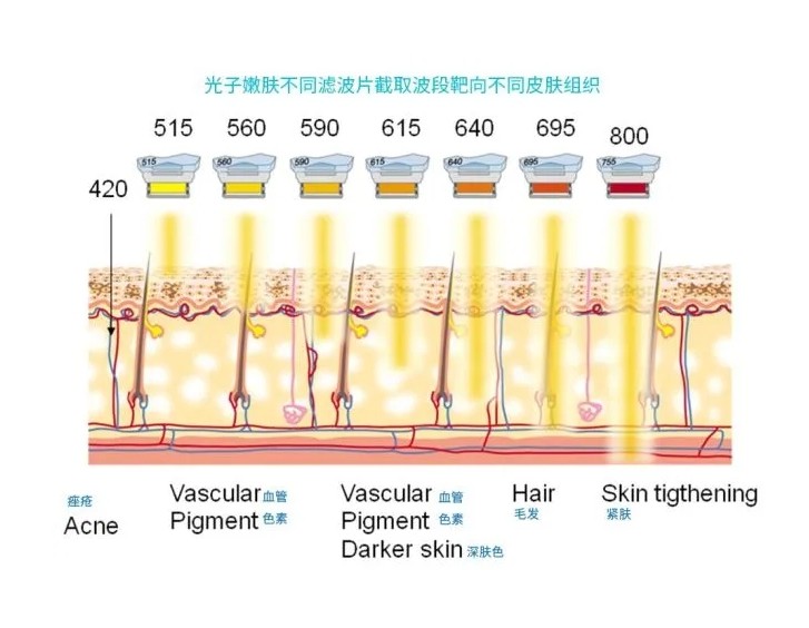五大光子嫩膚技術(shù)（IPL、DPL、OPT、APT、BBL）及濾光片區(qū)別